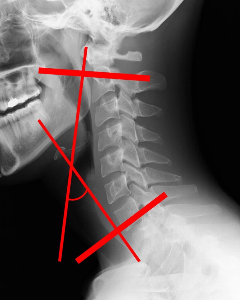 頭部と頸部の動き 解説図 18