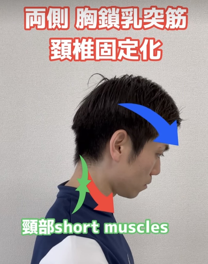 胸鎖乳突筋 解説図 5